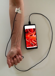 braccio, cellulare, filo, rosso, pugno, mano, telefono, dita, cerotto, cavo, sangue, trasfusione, schermo, nero